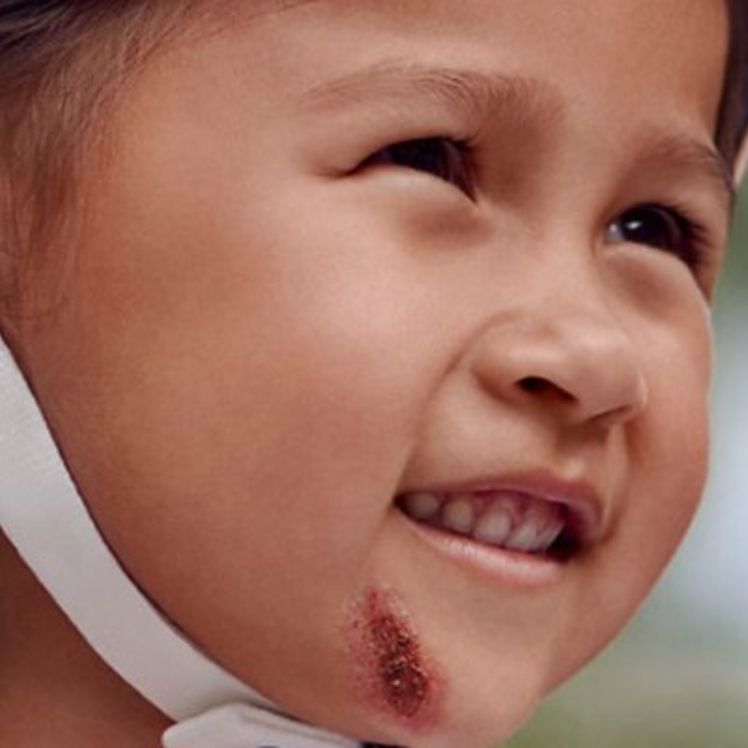 Dans quelles situations utiliser les soins Cicabio ?