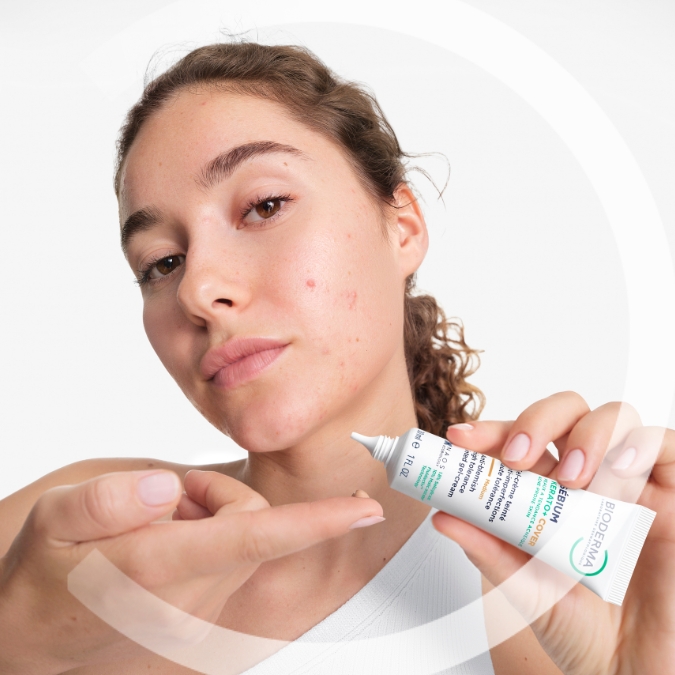 Ensemble contre l’acné-exil !