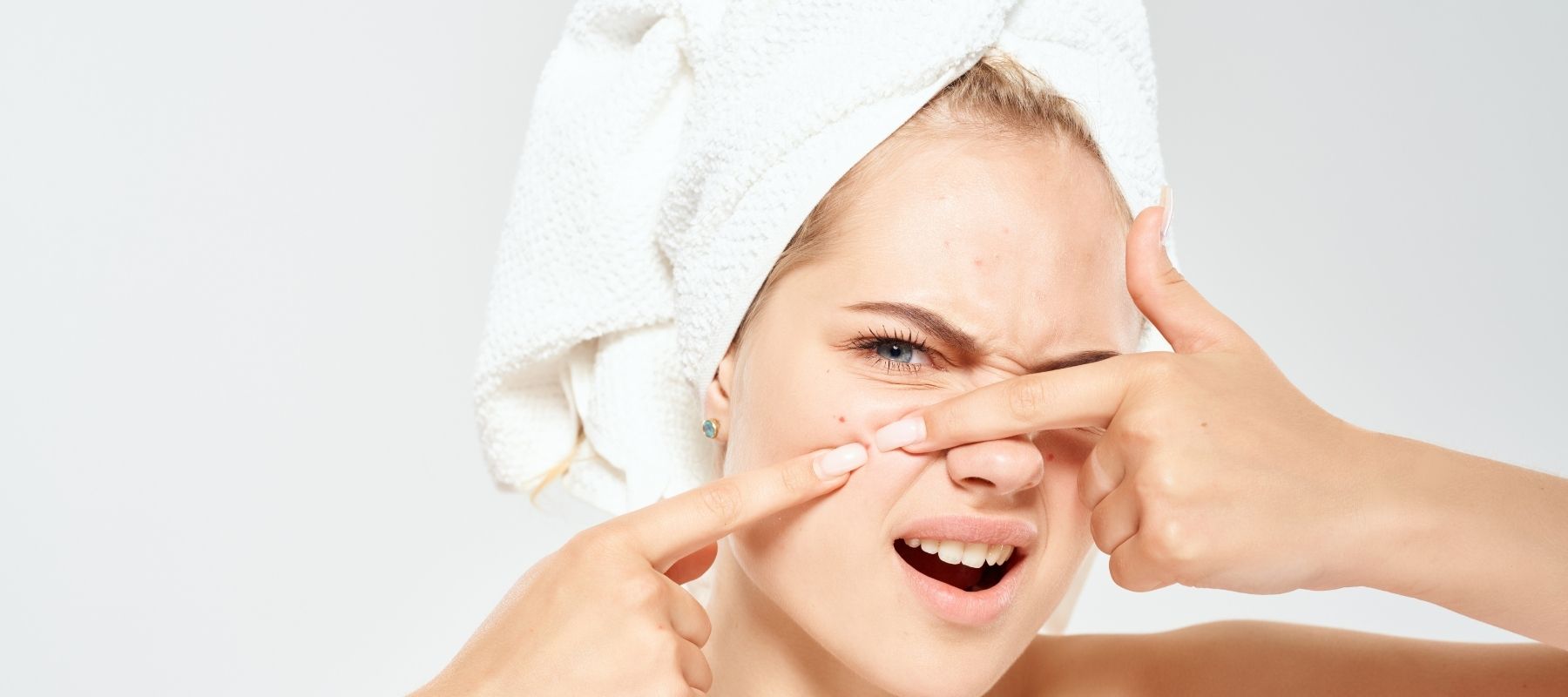 Acne adulte