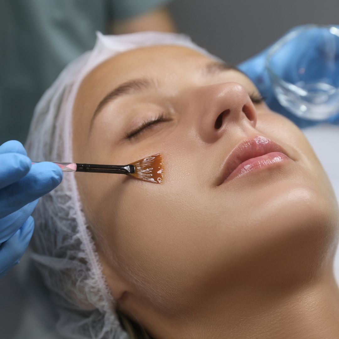 Peeling dermatologue