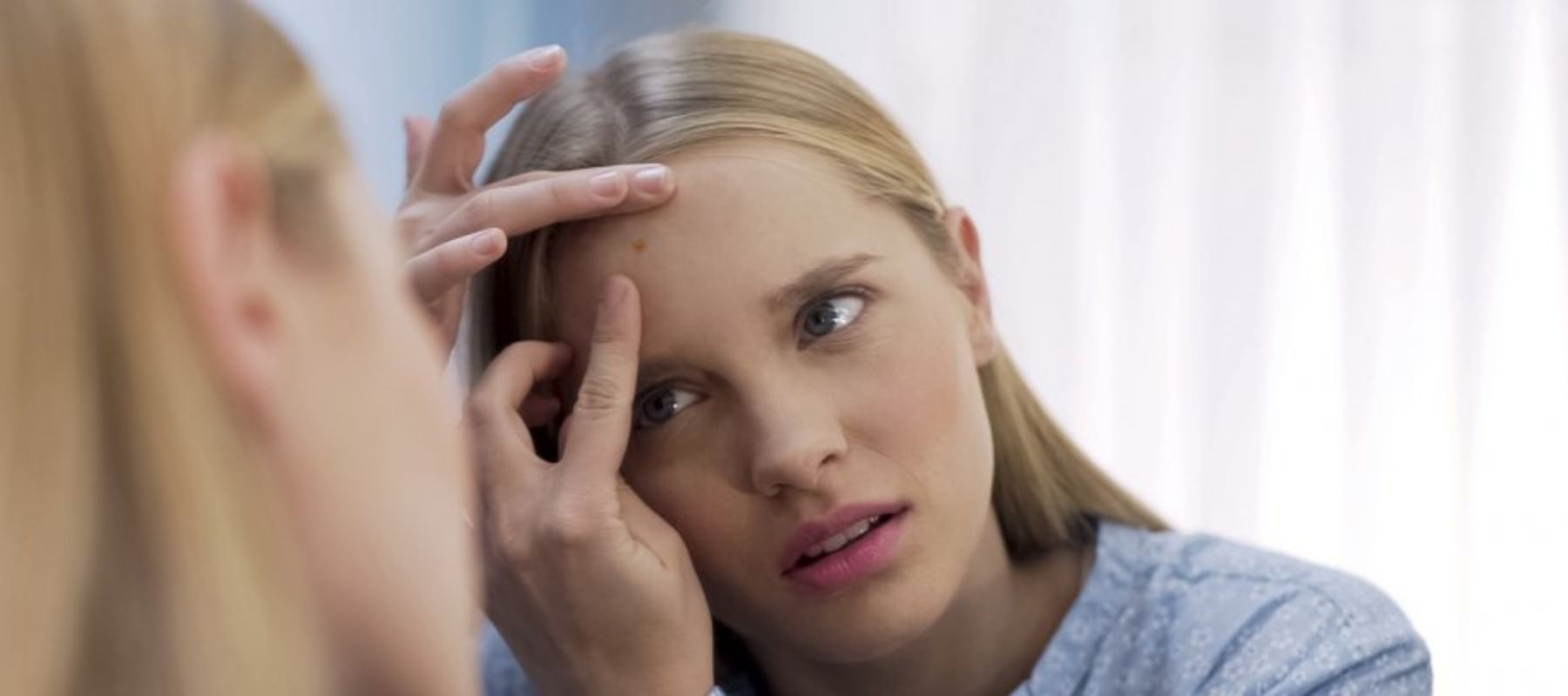 acne-rententionnelle