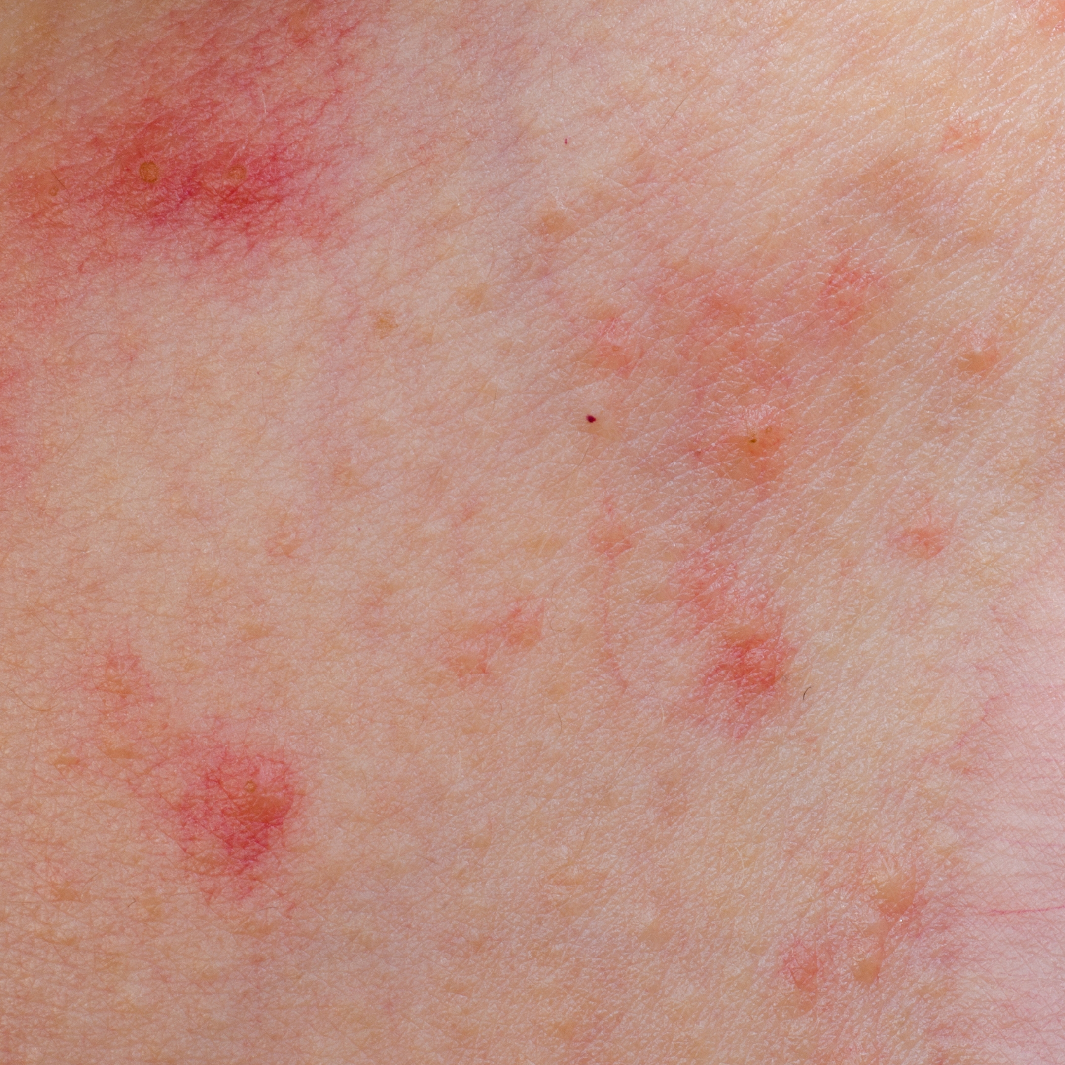 accalmie