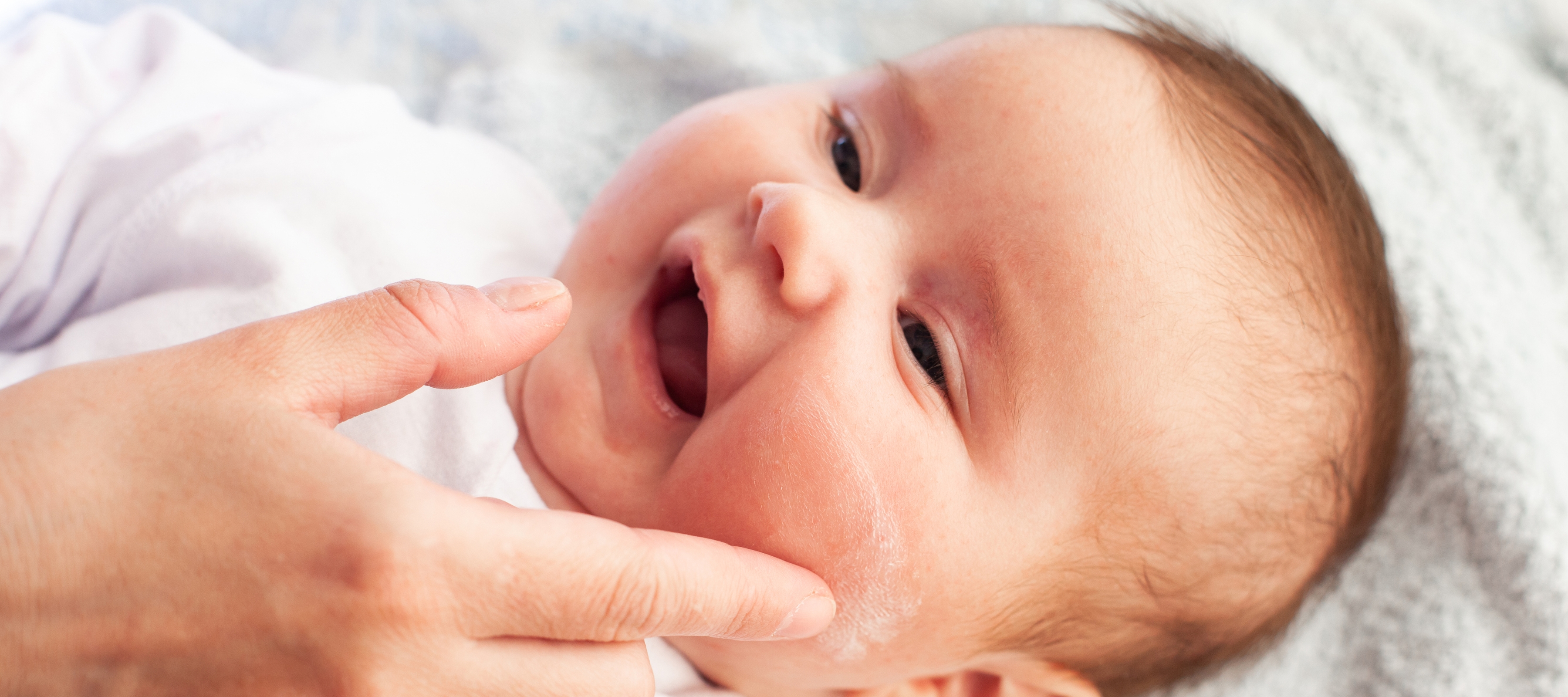 Peau atopique et eczéma : tout savoir sur la derma