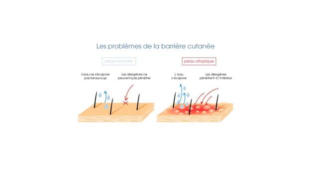 barriere