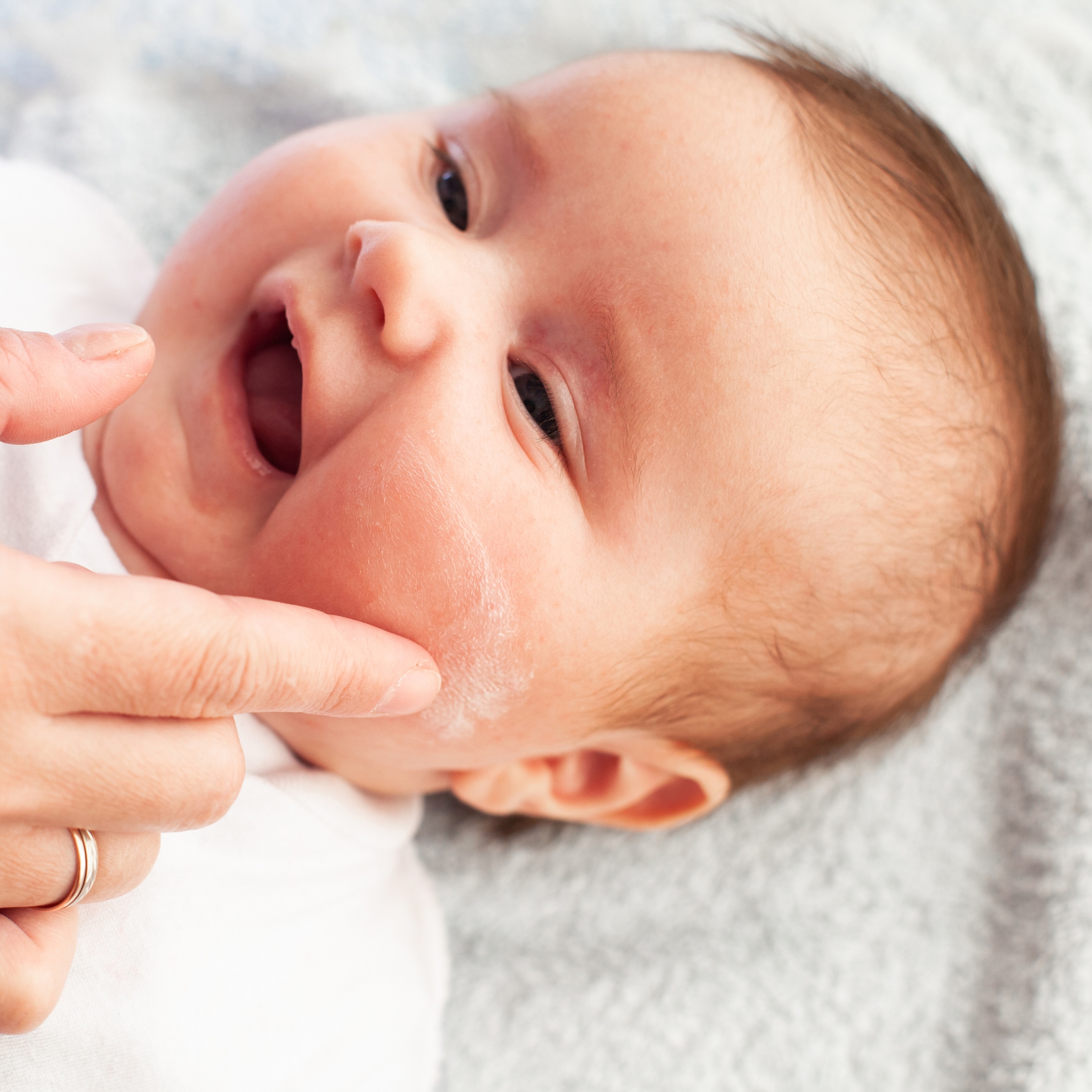 Peau atopique et eczéma : tout savoir sur la dermatite atopique de bébé