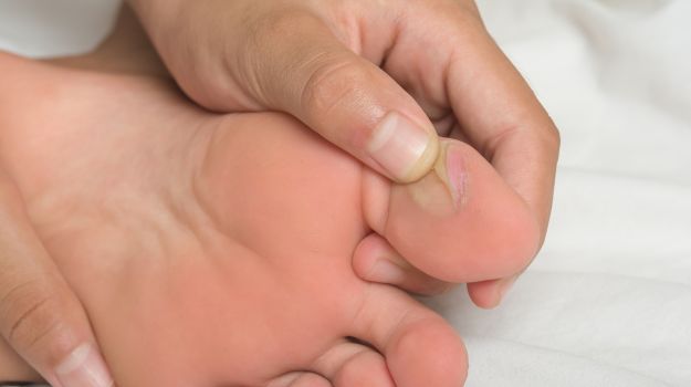 Déformations des pieds