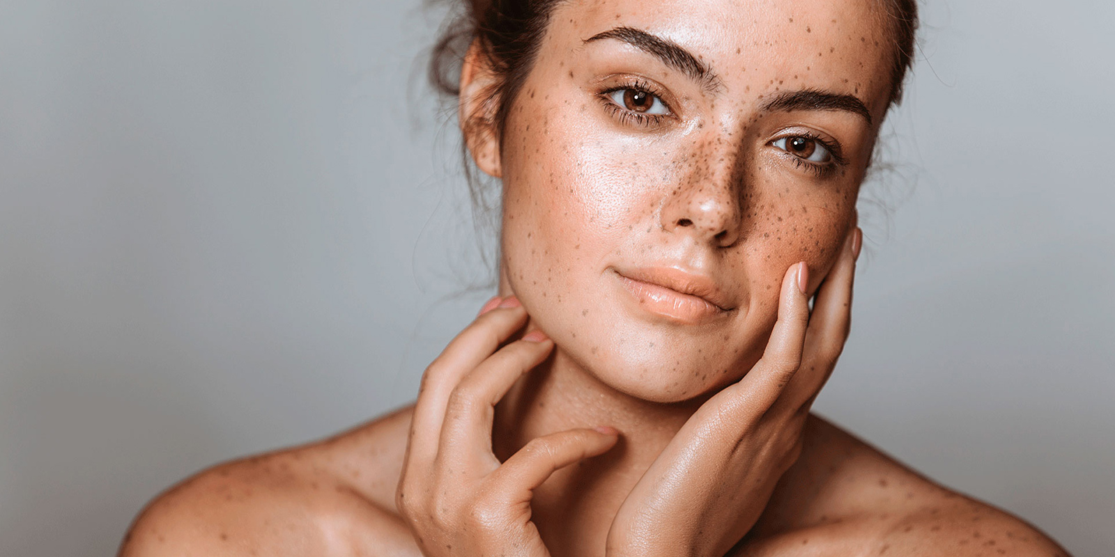 Visage de femme avec des taches brunes