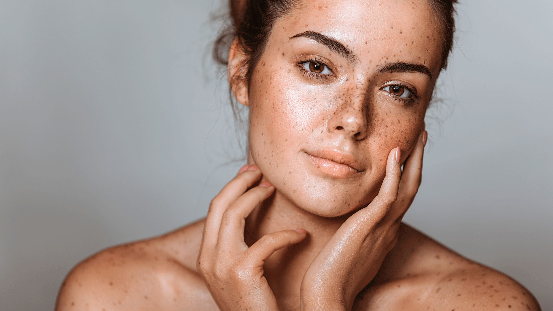 Tâches sur la peau : tâches brunes & problèmes de pigmentation