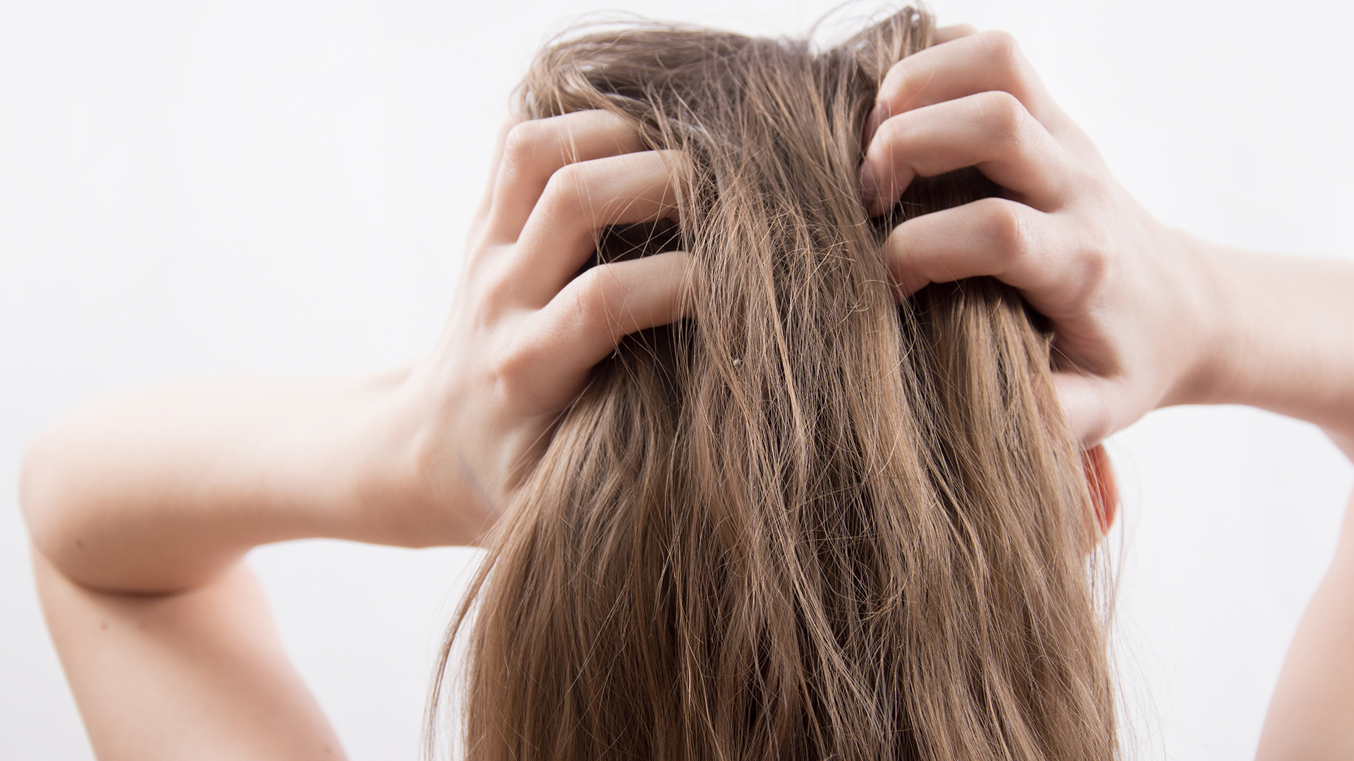 Eczema Demangeaison Du Cuir Chevelu Comment S En Debarrasser