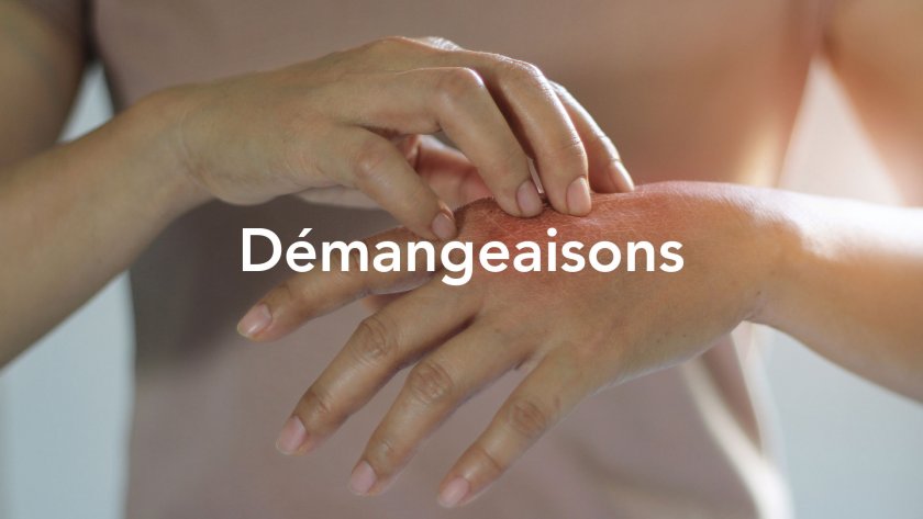 démangeaisons mains abîmées