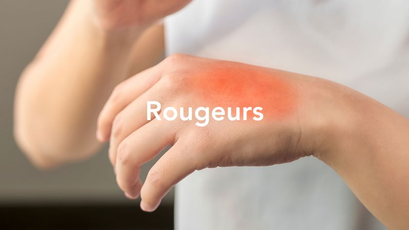 rougeurs mains abîmées