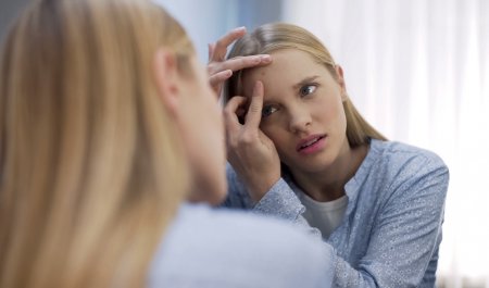 Une femme se perce les boutons d'acné