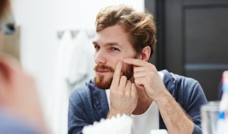 Une homme touche ses boutons d'acné