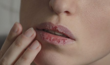 Une femme avec les lèvres sèches