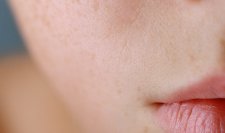 La peau déshydratée Un visage à la peau déshydratée