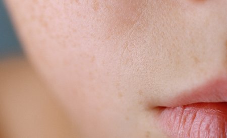 Peau déshydratée visage et corps : symptômes, causes et solutions