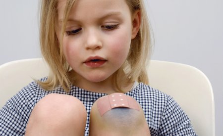 Un enfant à la peau abîmée