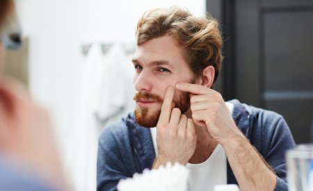 Une homme touche ses boutons d'acné