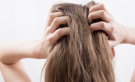 Eczema Demangeaison Du Cuir Chevelu Quel Traitement Eczema Demangeaison Du Cuir Chevelu Quel Traitement