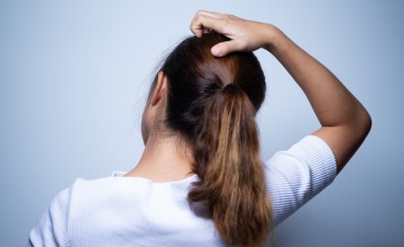 dermite séborrhéique démangeaisons dermite séborrhéique démangeaisons