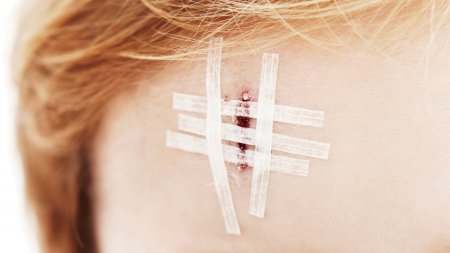 Une cicatrice sur le visage