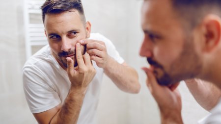 Un homme adulte avec de l'acné