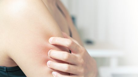 Une femme se gratte le bras