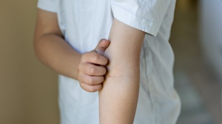 eczéma bras enfant