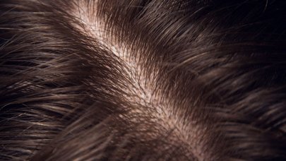 Comment respecter son Équilibre Capillaire pour des cheveux en bonne santé