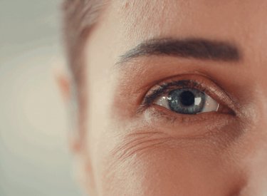 ridules sous les yeux