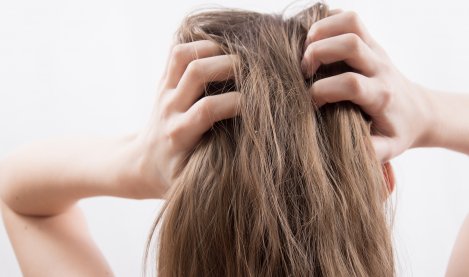 Une femme se gratte le cuir chevelu